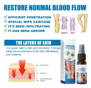 SPRAY DE TRATAMIENTO DE VARICES - Veinhealing