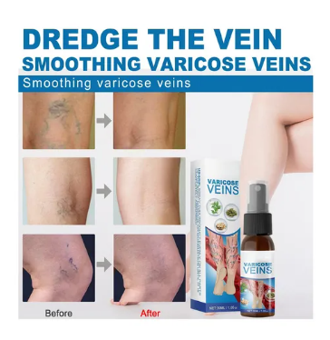 SPRAY DE TRATAMIENTO DE VARICES - Veinhealing